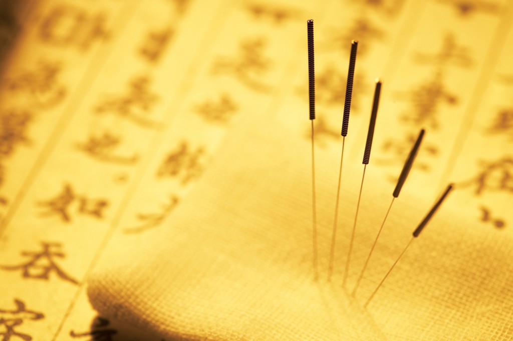 针刺图片 - Y & Y Acupuncture and Chiropractic
